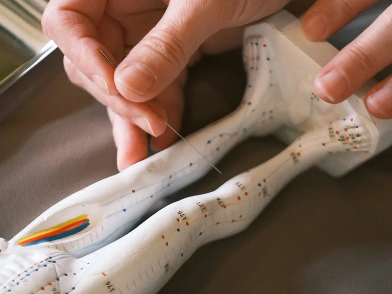 Acupuncture at Health & Healing Family Chiropractic in Andover