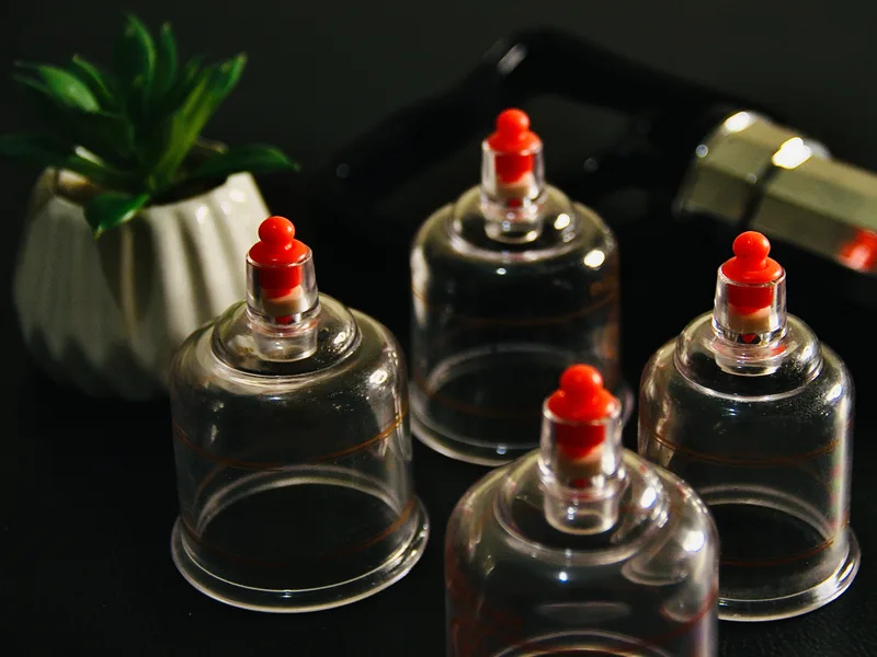 How Cupping Therapy works at Health & Healing Family Chiropractic