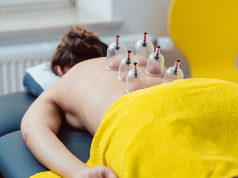 Cupping Therapy at Health & Healing Family Chiropractic in Andover