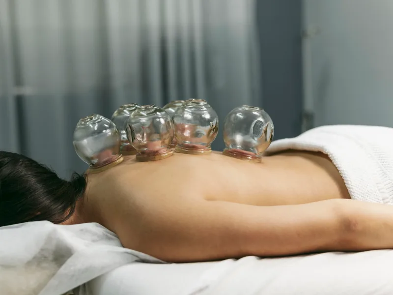 Cupping Therapy at Health & Healing Family Chiropractic in Andover