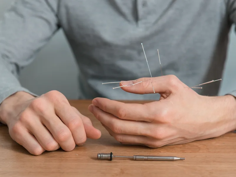 Dry Needling at Health & Healing Family Chiropractic in Andover