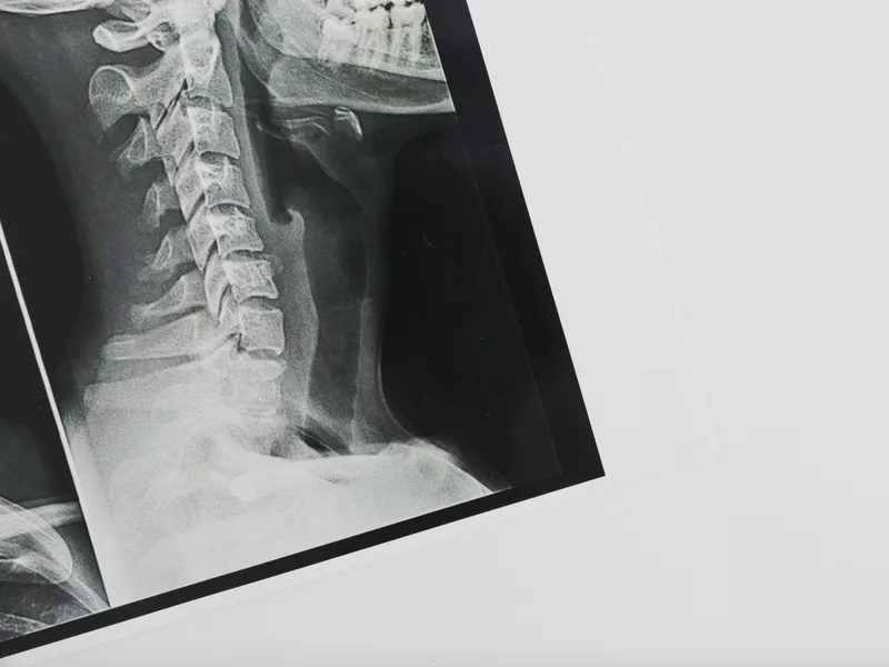 X-Rays at Health & Healing Family Chiropractic in Andover